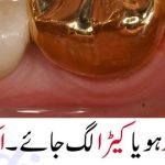 One-Minute Homemade Solution to Stop Tooth Decay