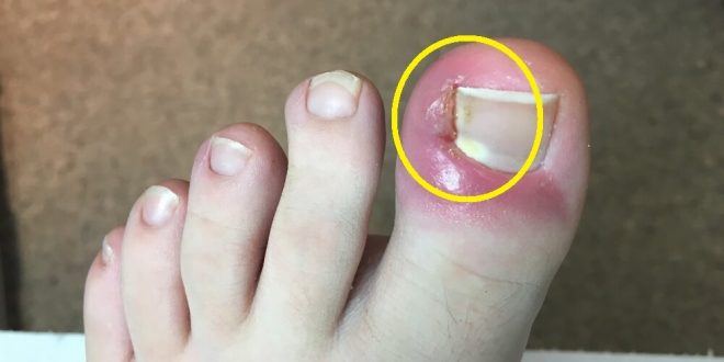 Ways to Strengthen Your Body’s Natural Defenses